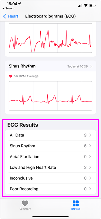 ecgs in health app