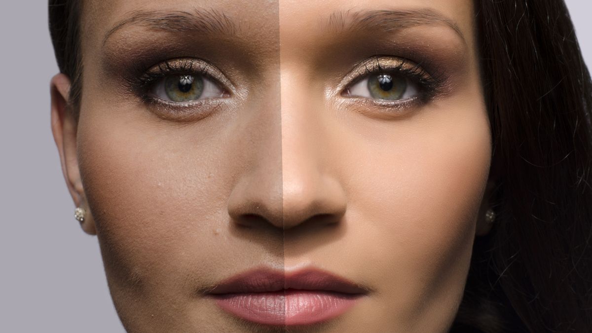 Closeup of a woman's face, with before and after comparison of retouching.