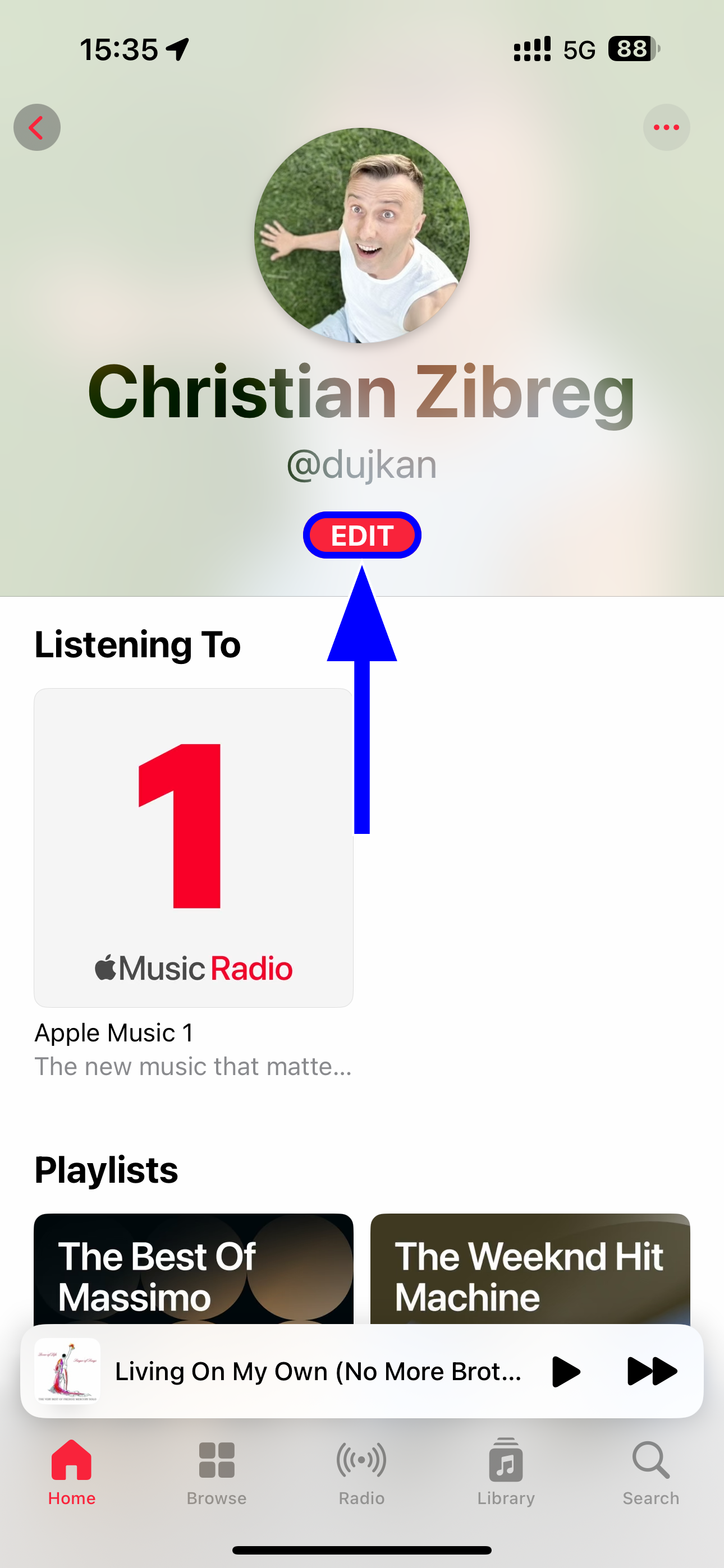 The Music app on iPhone with the Edit button on user profile highlighted.